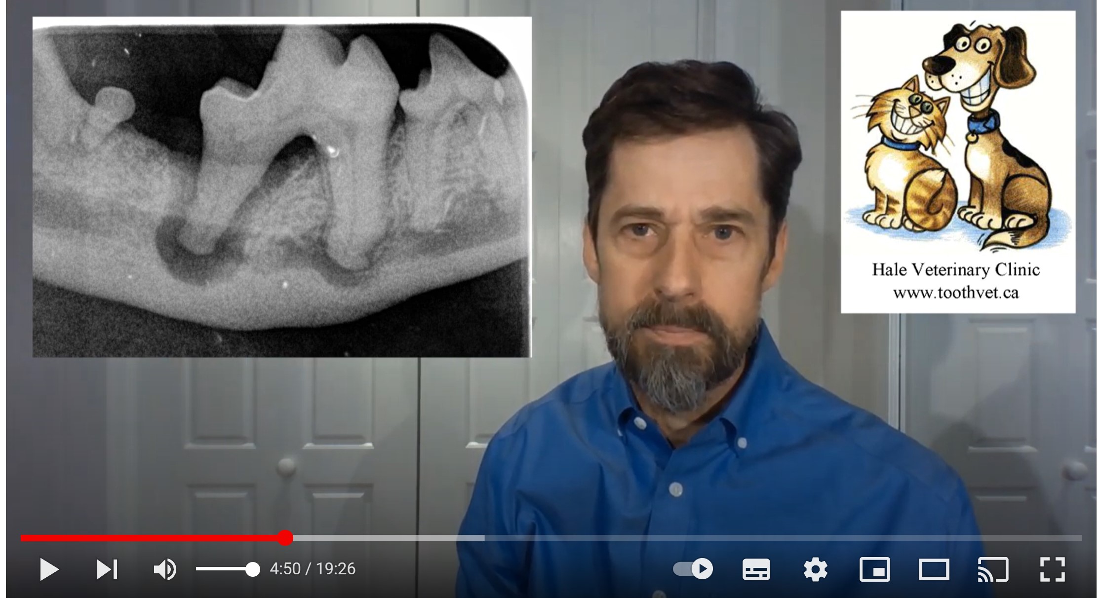 My Video on Anesthesia-Free Dentistry